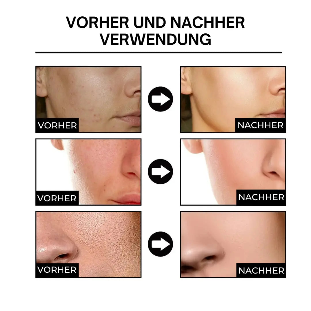 Dermavell™ Hautglättungsserum - Emilia Kollektiv