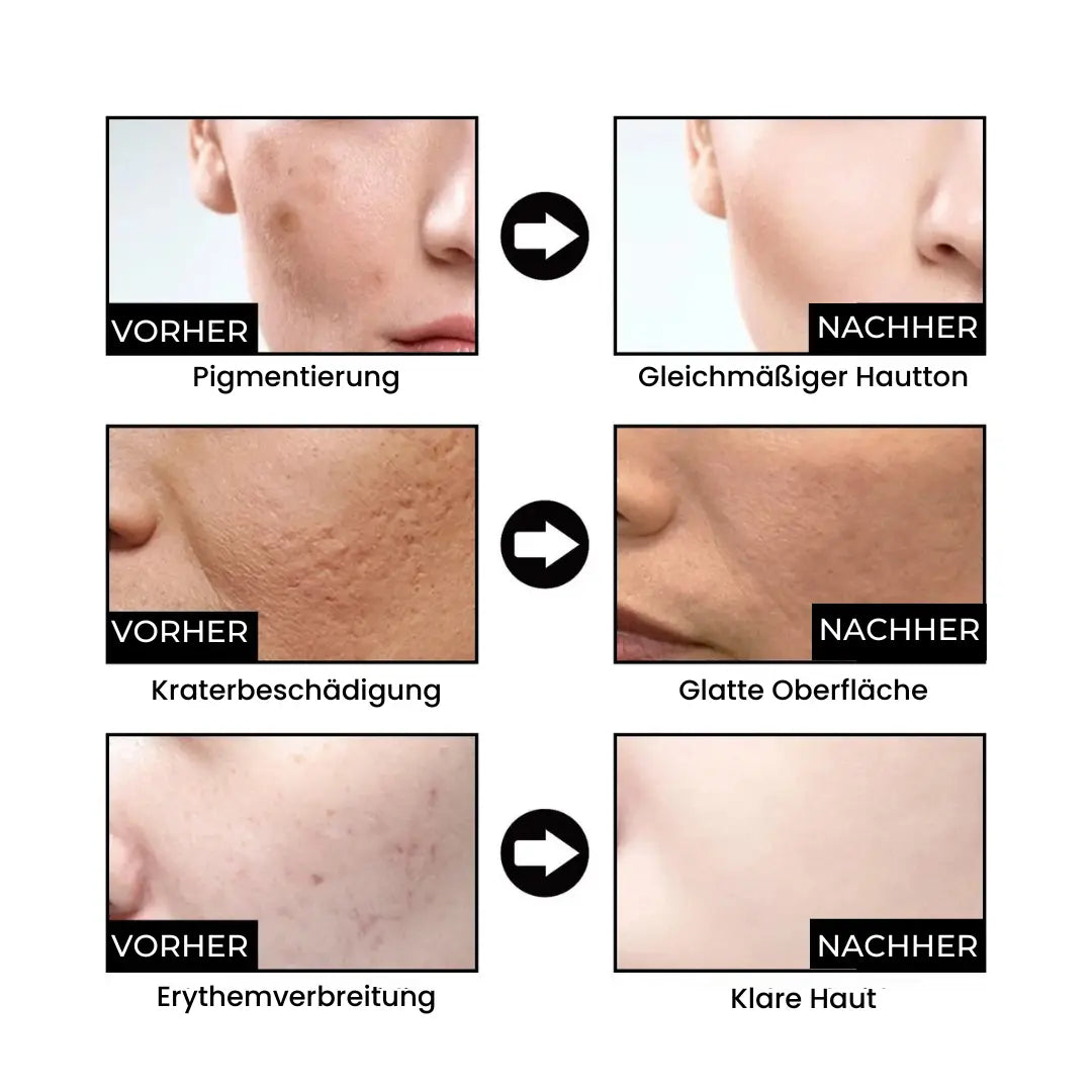 Dermavell™ Hautglättungsserum - Emilia Kollektiv