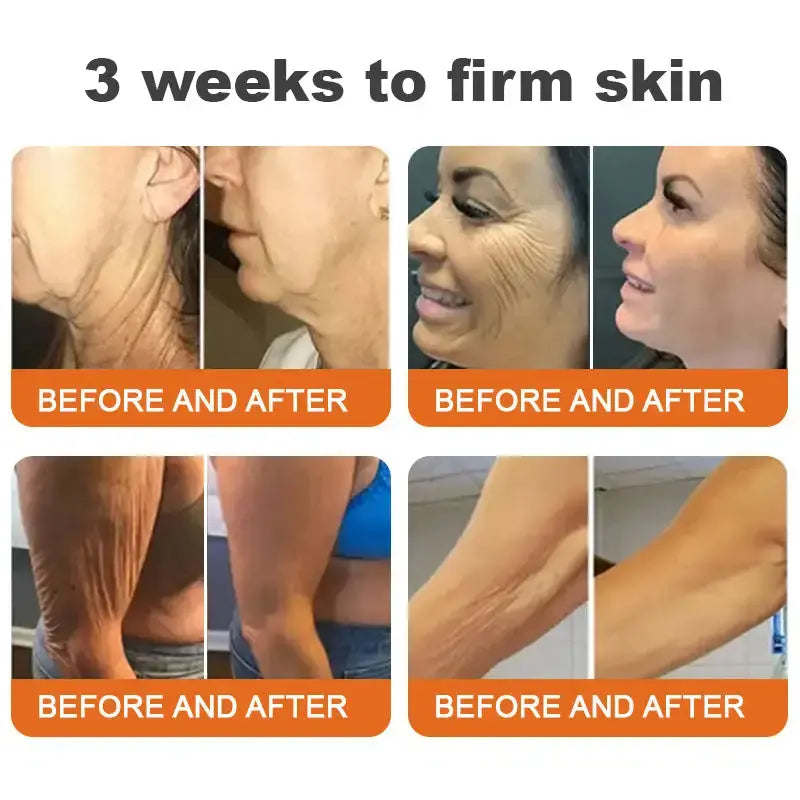 🐝Made and Shipped from USA✨Flysmus™ Botox Bee Venom Firming Serum Stick🔥LAST DAY 70% OFF Emilia Kollektiv