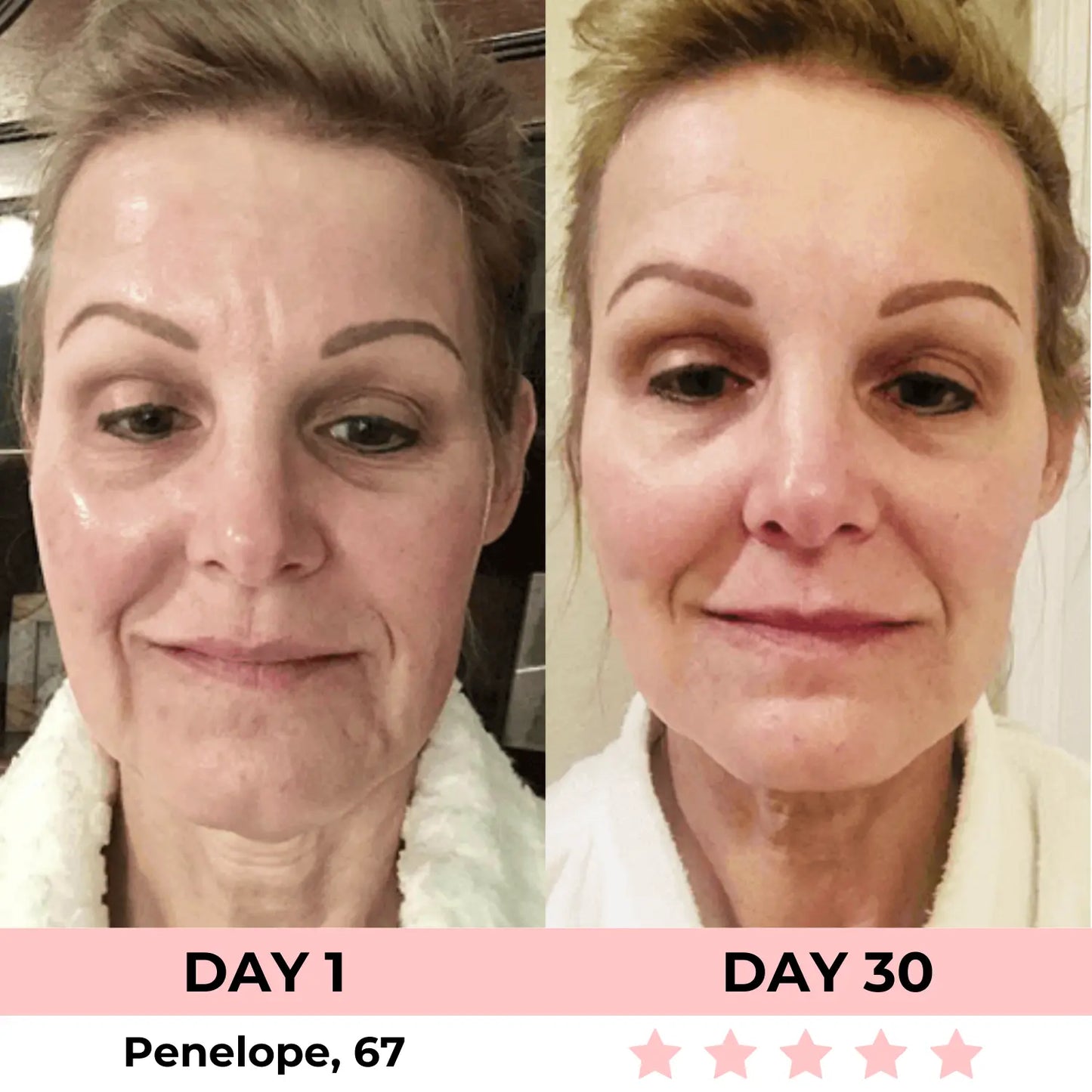GlowSculpt Pro™: 7-in-1 LED Gesichtsformer für Lifting & Strahlende Haut | Mit EMS Mikrostrom & Lichttherapie - Emilia Kollektiv
