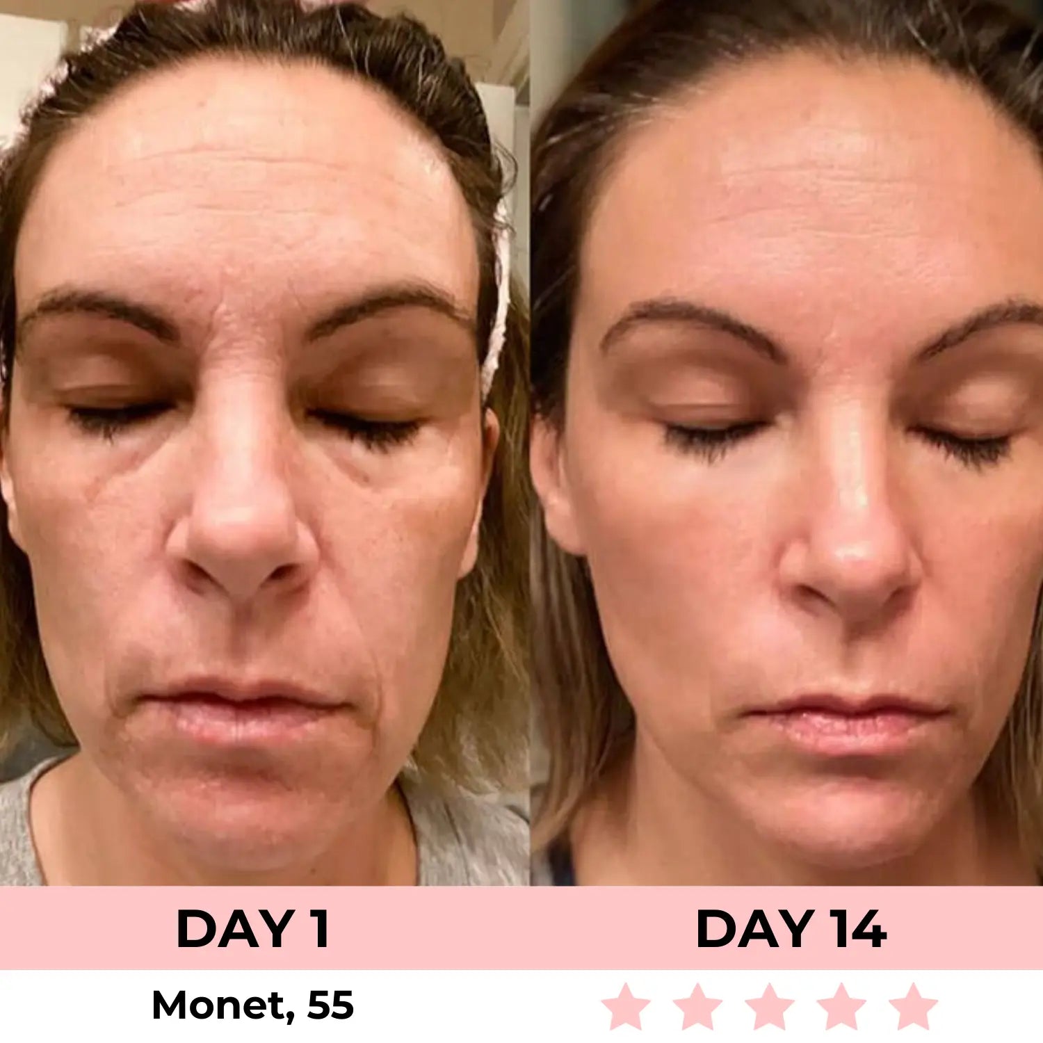 GlowSculpt Pro™: 7-in-1 LED Gesichtsformer für Lifting & Strahlende Haut | Mit EMS Mikrostrom & Lichttherapie - Emilia Kollektiv