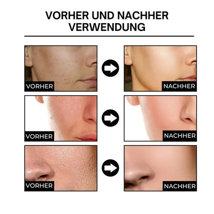 Dermavell™ Hautglättungsserum - Emilia Kollektiv