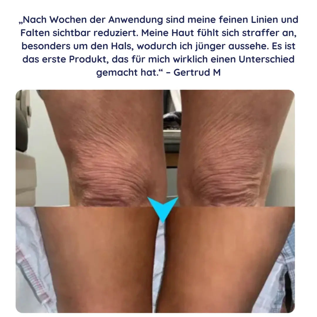 Firméa™ – Straffende Anti-Aging-Creme gegen Falten und schlaffe Haut - Emilia Kollektiv