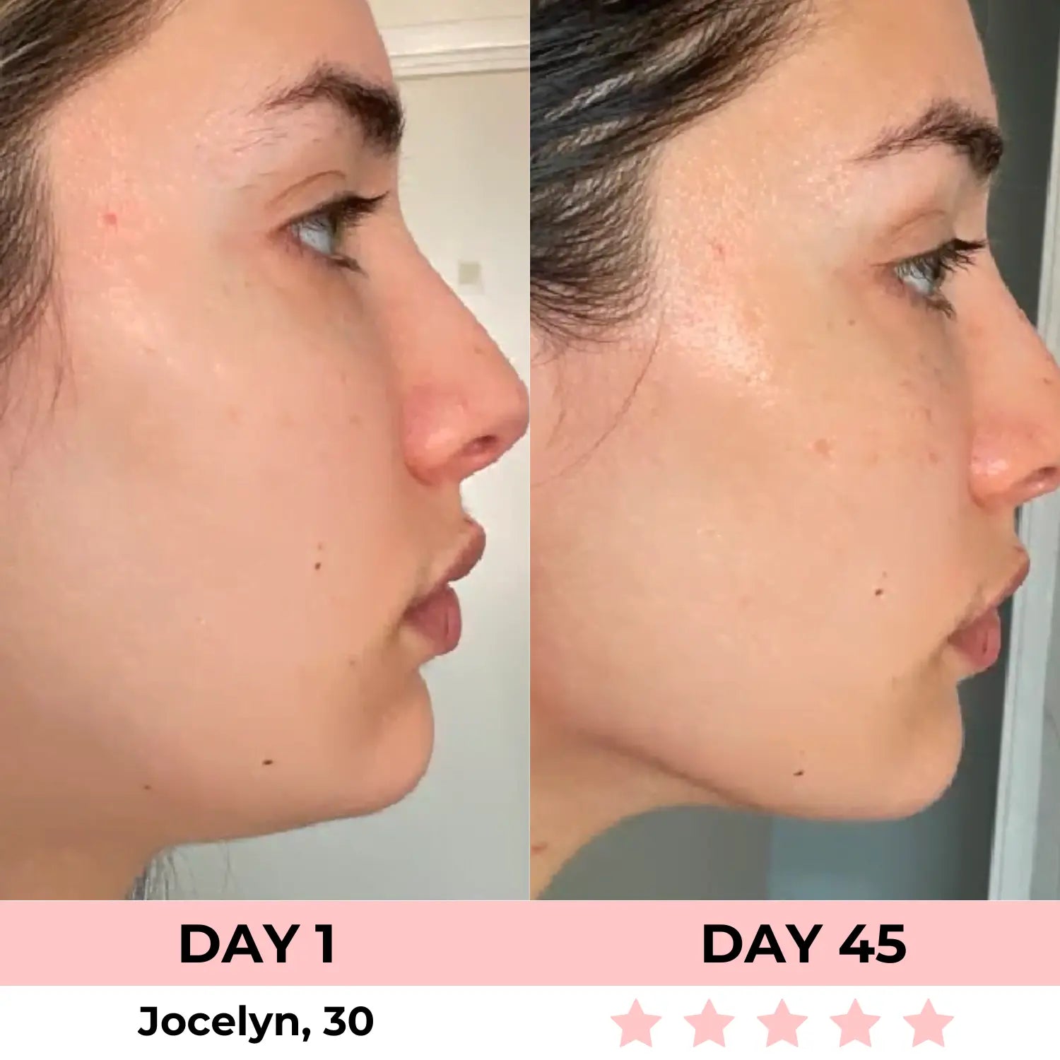 GlowSculpt Pro™: 7-in-1 LED Gesichtsformer für Lifting & Strahlende Haut | Mit EMS Mikrostrom & Lichttherapie - Emilia Kollektiv