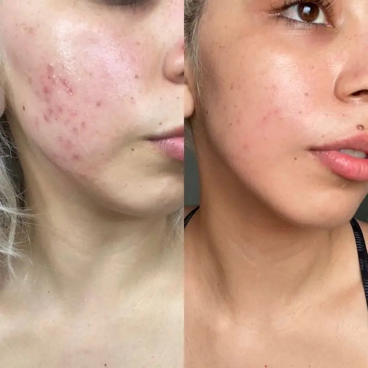 LuxGlow™ - LED-Maske für strahlende, jugendliche Haut - Emilia Kollektiv