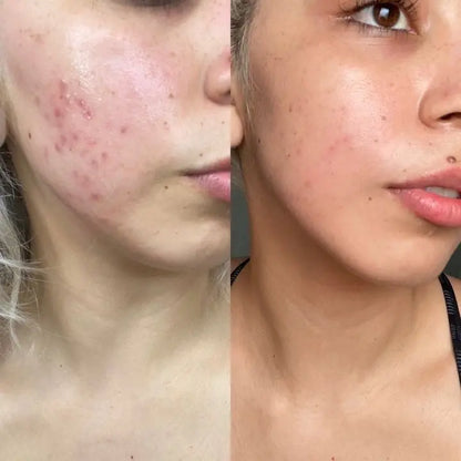 LuxGlow™ - LED-Maske für strahlende, jugendliche Haut - Emilia Kollektiv