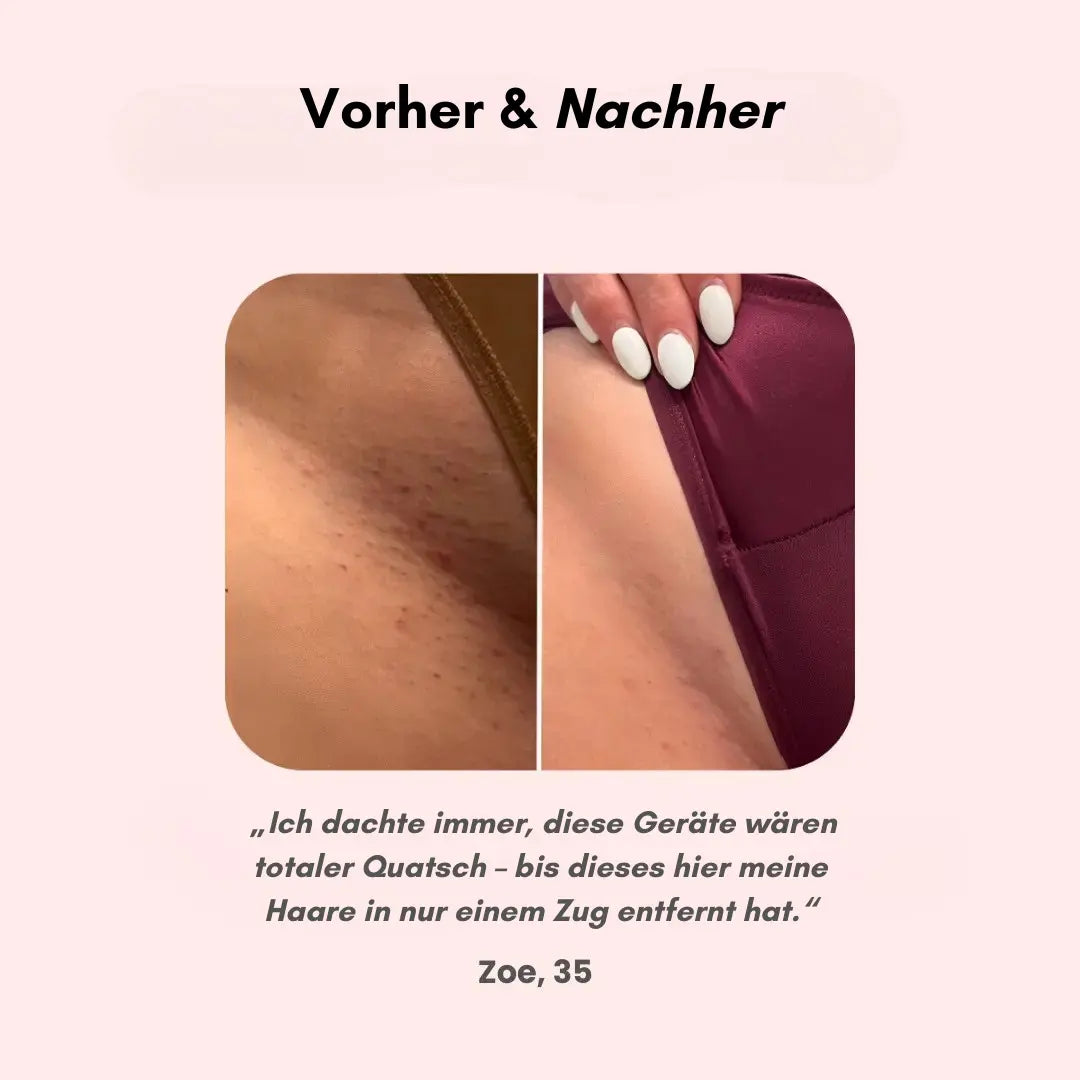 SeidigGlat™ Rasierer: Schluss mit Rasurbrand & eingewachsenen Haaren – Für sofort seidig glatte Haut! - Emilia Kollektiv