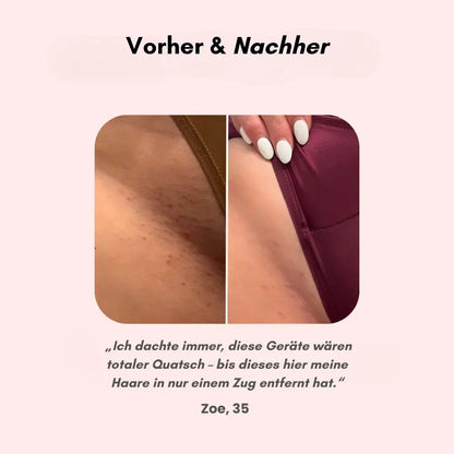 SeidigGlat™ Rasierer: Schluss mit Rasurbrand & eingewachsenen Haaren – Für sofort seidig glatte Haut! - Emilia Kollektiv