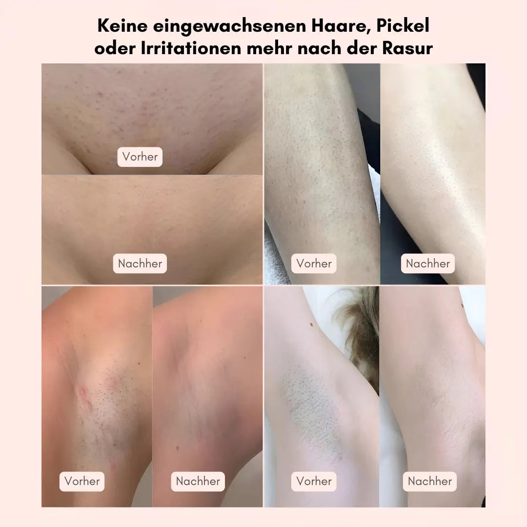 SeidigGlat™ Rasierer: Schluss mit Rasurbrand & eingewachsenen Haaren – Für sofort seidig glatte Haut! - Emilia Kollektiv