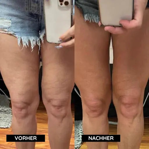 CelluClear™ - Emilia Kollektiv